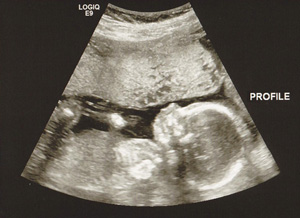 Ultrasound of our daughter!